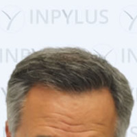 inpylus