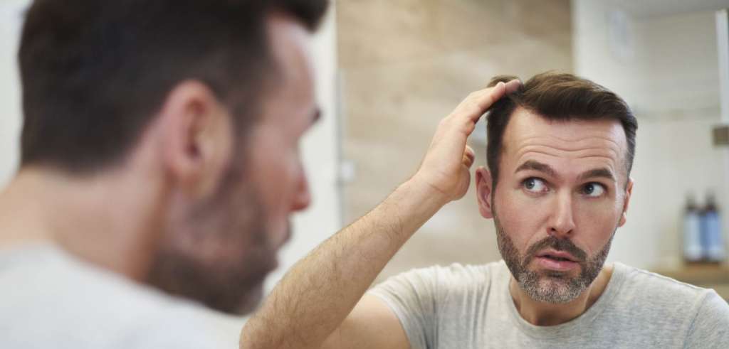 Hipotiroidismo y caída de pelo: ¿Cuál es su relación?
