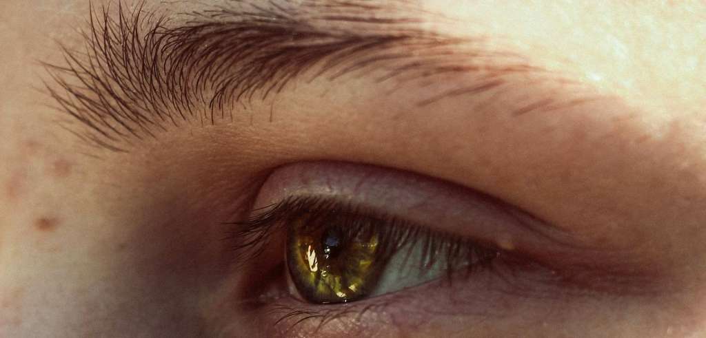 Postoperatorio trasplante cejas