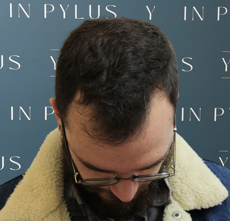 inpylus