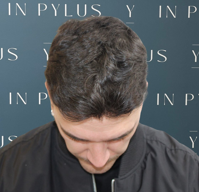 inpylus
