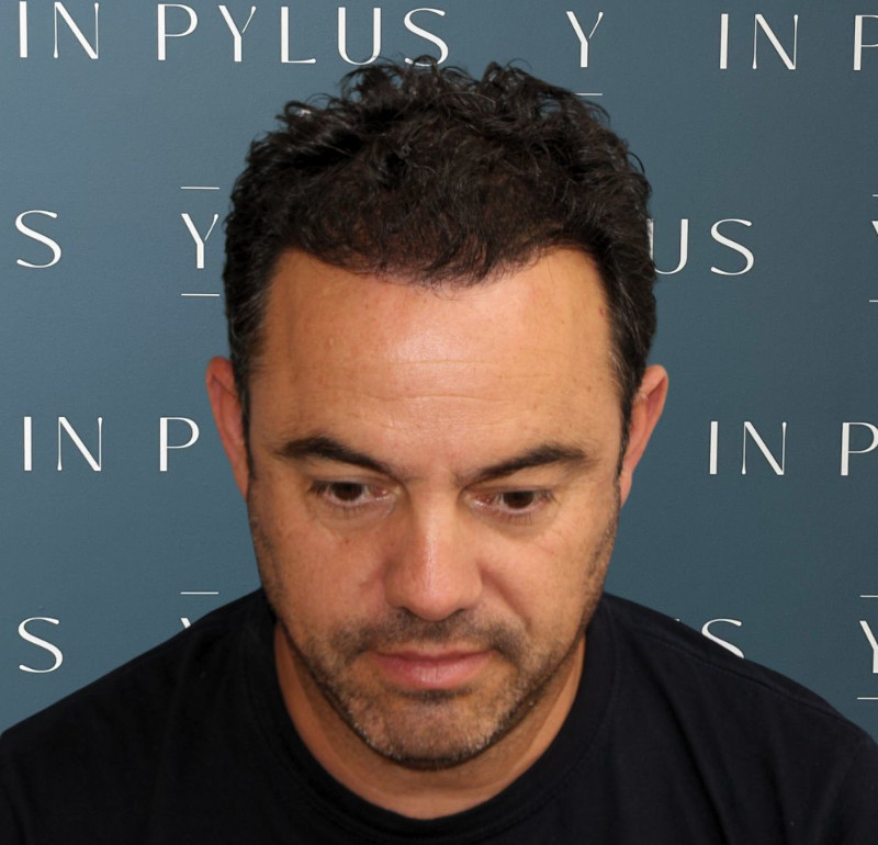 inpylus